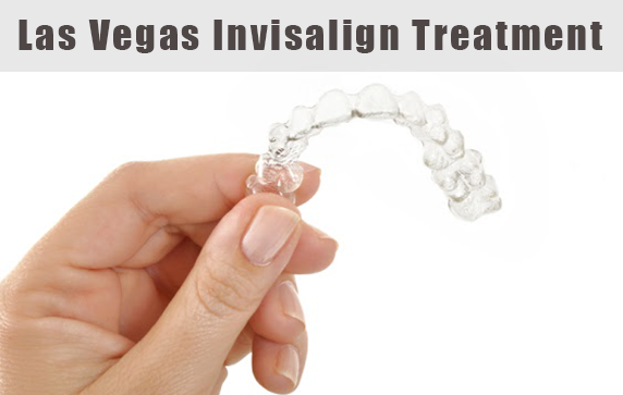 Las-Vegas-Invisalign-Treatment